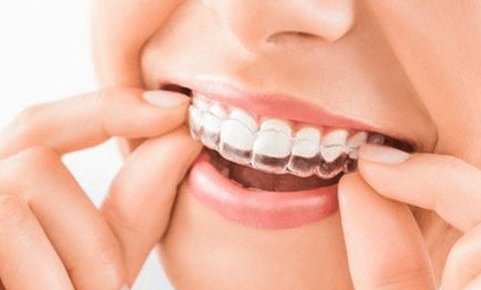 株洲矫正牙齿专家医生排行榜(图3)