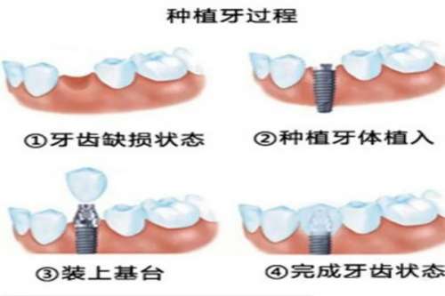 江阴排名不错的5家公立口腔科揭晓，江阴市人民医院正畸和口腔疾病治疗医生技术良好！
